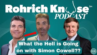 What The Hell Is Going On With Simon Cowell Face