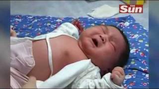 Massive baby weighing 15 pounds born in China