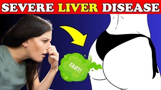 LIVER is DYING? 17 Warning Signs You Must Know | Healthy Care