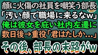 【感動する話】顔に火傷がある陰キャ社員を見下す上司「化粧くらいしろバケモノがw」彼女を庇った俺は窓際部署に社内左遷させられた。ある日→会社の重役が視察に来ると「君は確か…」俺「あ！」【泣ける