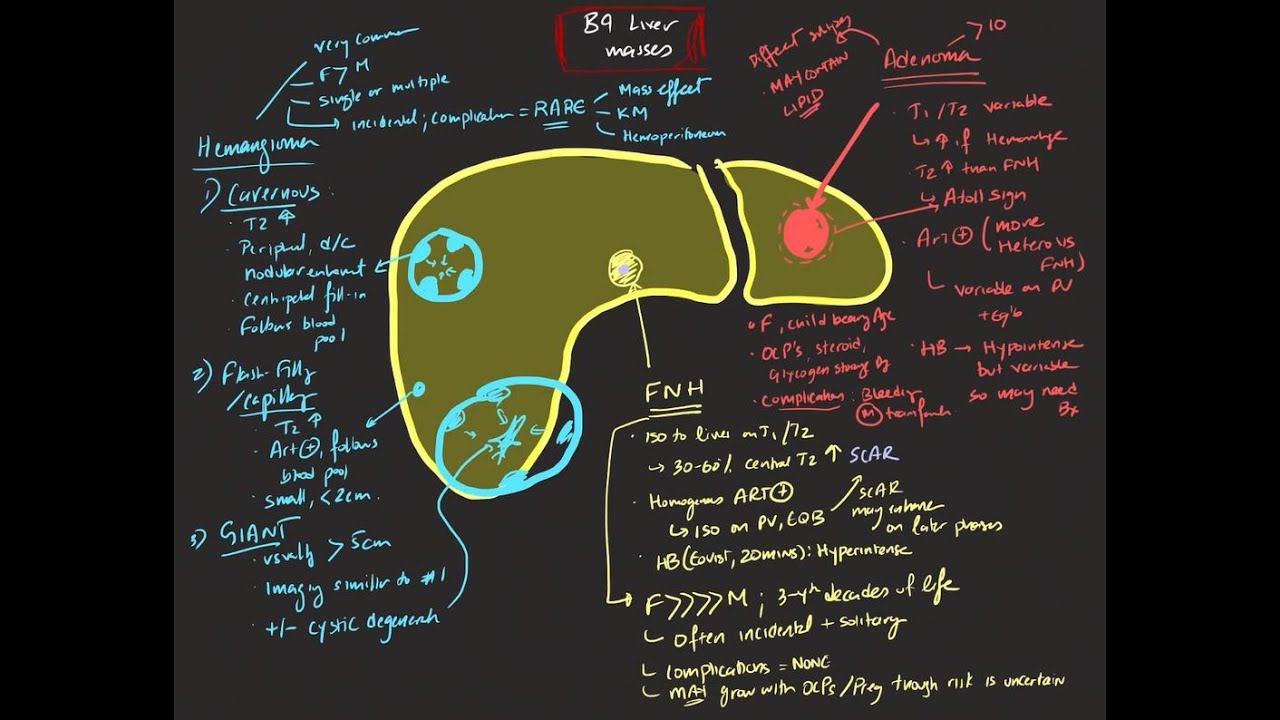 Benign Liver Masses Youtube