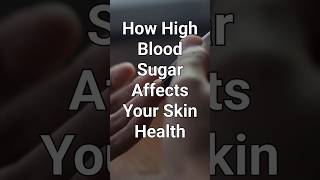 High Blood Sugar Affects your Skin Health I #shorts #youtubeshorts #skin #diabetes #bloodsugar  #dm