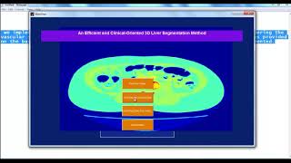 Mini Projects Using Matlab | Mini Thesis Using Matlab | Mini Projects Code Using Matlab