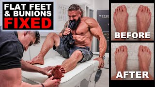The WORST PAIN | Fixing BUNIONS & FLAT FEET Without Surgery! | Trigger Point Therapy (Lex Fitness)