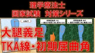 【重要】大腿義足の異常歩行が分かる！大腿義足のTKA線・初期屈曲角　～No 118 理学療法士国家試験対策　シリーズ～