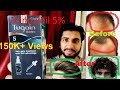 Tugain 5 Solution ( Minoxidil 5% ) For Hair Regrowth |Review in Hindi| Hair Loss Treatment | India