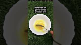 ত্বকের মেচেদা কালো দাগ দূর হবে মাত্র 3 দিনে //চেহারা ফর্সা ধবধবে হবে//