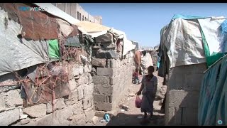 The War In Yemen: Everyday is a struggle for survival