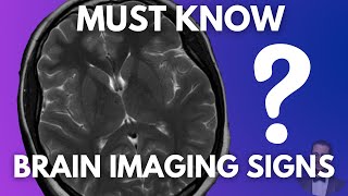 How to Recognise These Common Neuro-radiological Findings?