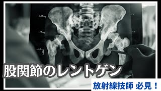 【レントゲンのトリカタ講座】現役放射線技師が股関節のレントゲン撮影を解説します！(pert1)