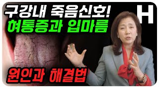 혀가 아프고 입이 말라요! 입마름, 구강건조, 입냄새, 혀갈라짐의 원인은 이것입니다