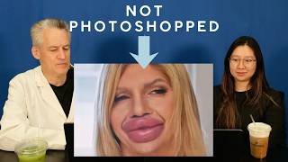 Plastic Surgeon Reacts to the World's BIGGEST LIPS?