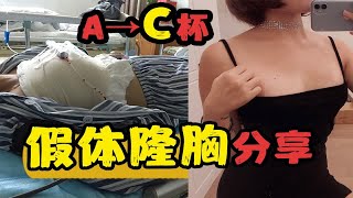 【假体隆胸过程分享】痛哭了！为什么我选择了假体？术后怀疑人生 | 术后恢复建议 | 整形经验分享