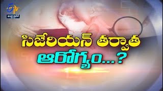 Care after cesarean | Sukhibhava | 26th May 2022 | ETV Andhra Pradesh