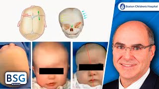 Craniosynostosis Grand Rounds | Neurosurgery Course | February 21, 2023