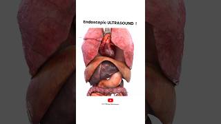 Endoscopic Ultrasound procedure | Short Animated Video