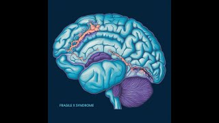 Understanding Fragile X Syndrome   The Role of BabyMap