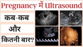 Pregnancy में अल्ट्रसाउंड कब और कितनी बार करना चाहिए | Sonography In Pregnancy