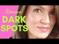 AFFORDABLE!!! Skincare Routine for MELASMA, AGE SPOTS, HYPERPIGMENTATION, DARK SPOTS