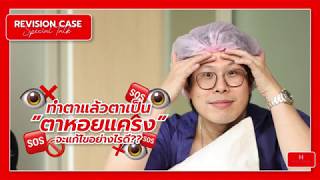 Ep.64 ตาหอยแครงเกิดจากอะไร แก้ไขได้อย่างไร? - นพ. พลพงศ์ ชยางศุ - หมอโบ๊ท - [ทองหล่อแฮปปี้]