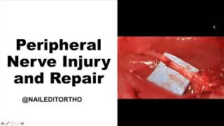 Peripheral Nerve Injury & Repair w/ Dr. Christopher Dy