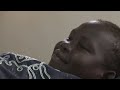 south sudan growing need for amputee care