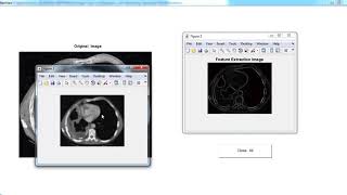 Biomedical Image Processing Projects | Biomedical Image Processing Thesis