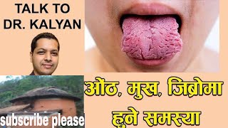 ओंठ, मुख, जिब्रोमा हुने समस्या ,Lips,mouth,tongue problem  || by  Dr Kalyan