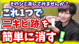 【ニキビ跡対策スキンケア】これ一本㊙️シミや色素沈着を簡単にケアする方法！