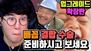 [하이라이트] 배꼽 결합 수술 준비 영상 (👉업그레이드 확장판👈)🤣😂🤣😂