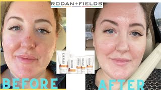 RODAN AND FIELDS - REVERSE BRIGHTENING REGIMEN ROUTINE AND REVIEW/HOW TO