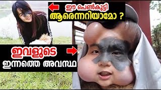 ഈ പെണ്‍കുട്ടി ആരെന്നു അറിയാമോ ? അവളുടെ ഇപ്പോഴത്തെ അവസ്ഥ കണ്ണ് നനയിക്കും !