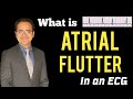 Atrial Flutter ECG Explained, Practice ECG's, Treatment, Symptoms, ECG Interpretation Lecture, USMLE