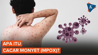 Mengenal Cacar Monyet (Mpox) yang Jadi Darurat Kesehatan Global