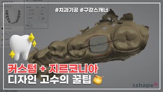 구강스캐너 커스텀 지르코니아 3shape 디자인