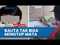 Kondisi Pilu Balita Korban Penyiraman Air Keras oleh Ayahnya, Tak Bisa Menutup Mata saat Tidur