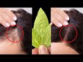 🔥Hair grows like crazy and doesn't fall out, this is the best remedy! Everyone crazy about it