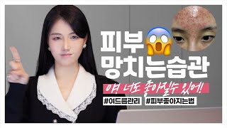 🙅🏻‍♀️피부 망치는 습관 BEST8 ❌ 좁쌀 여드름 극복! (이 영상 꼭 보세요 / 피부 좋아지는 법) **민감성 피부관리법!