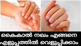 കൈകാൽ നഖം എങ്ങനെ  എളുപ്പത്തിൽ വെളുപ്പിക്കാം /how to whiten our nail in easy way