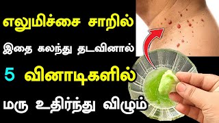 எலுமிச்சை சாறில் இதை கலந்து தடவினால் 5 வினாடிகளில் மரு உதிர்ந்து விழும் | Wart Removal | Skin Tag