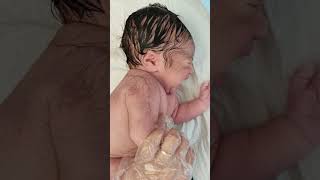 Newborn Baby with so much Body Hair just after birth #shorts