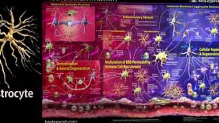 Neuroinflammation 360