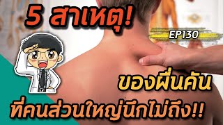 EP130 : 5 สาเหตุของผื่นคันที่คนส่วนใหญ่นึกไม่ถึง