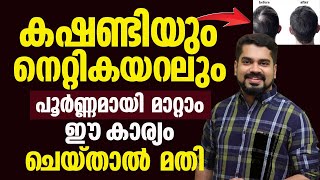 കഷണ്ടിയും നെറ്റികയറലും നിങ്ങളെ വല്ലാതങ്ങ് കുറവാക്കുന്നുണ്ടോ| എല്ലാറ്റിനും പരിഹാരമിതാ