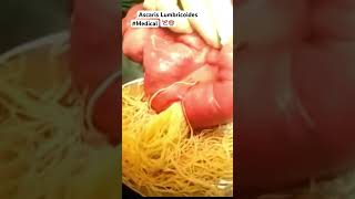 Ascaris Lumbricoides Parasito 🙊 #shorts #information #content