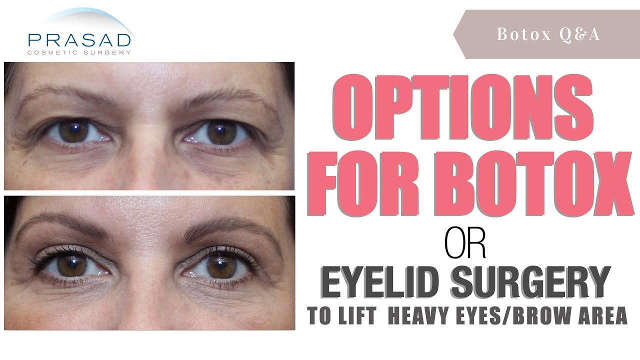Can Botox Raise Your Eyebrows Eyebrowshaper Can Botox Raise Your Eyebrows Eyebrowshaper