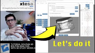 FULL TUTORIAL: BOLTON ANALYSIS IN DOLPHIN IMAGING 3D