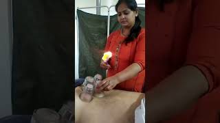 Cupping therapy | Easiest manner for Back pain | Quick pain solution | Natural pain relief | #shorts