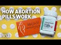 Medical Abortions: The Science Behind How Abortion Pills Work