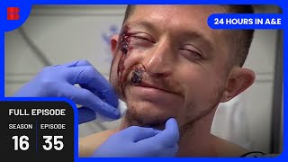 Bleeding Tonsils Nightmare  - 24 Hours in A&E - Medical Documentary
